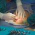 Doctor making an incision for a Cesarean section birth